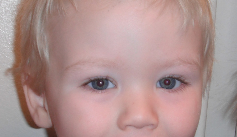 Breytingar á Skakkalandi